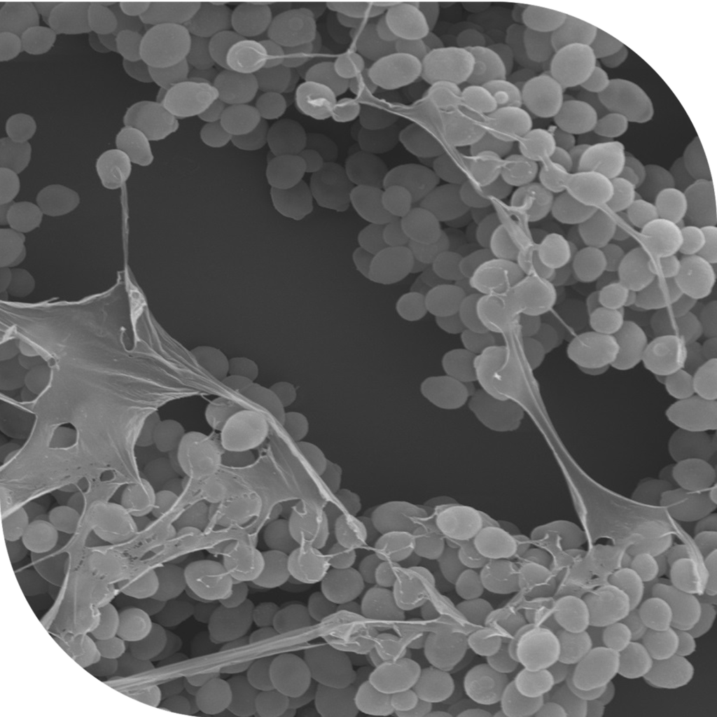 Microscopia de Varredura gentilmente disponibilizada por Nadia Parachin e Milton Gomes